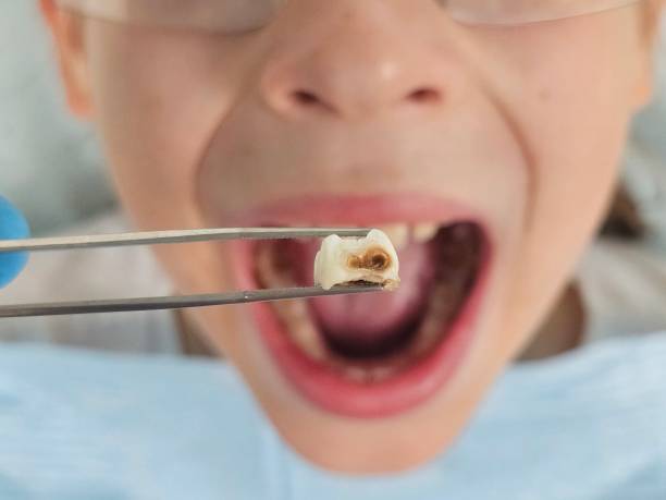 Best Emergency Dentist for Kids  in Rockwell City, IA